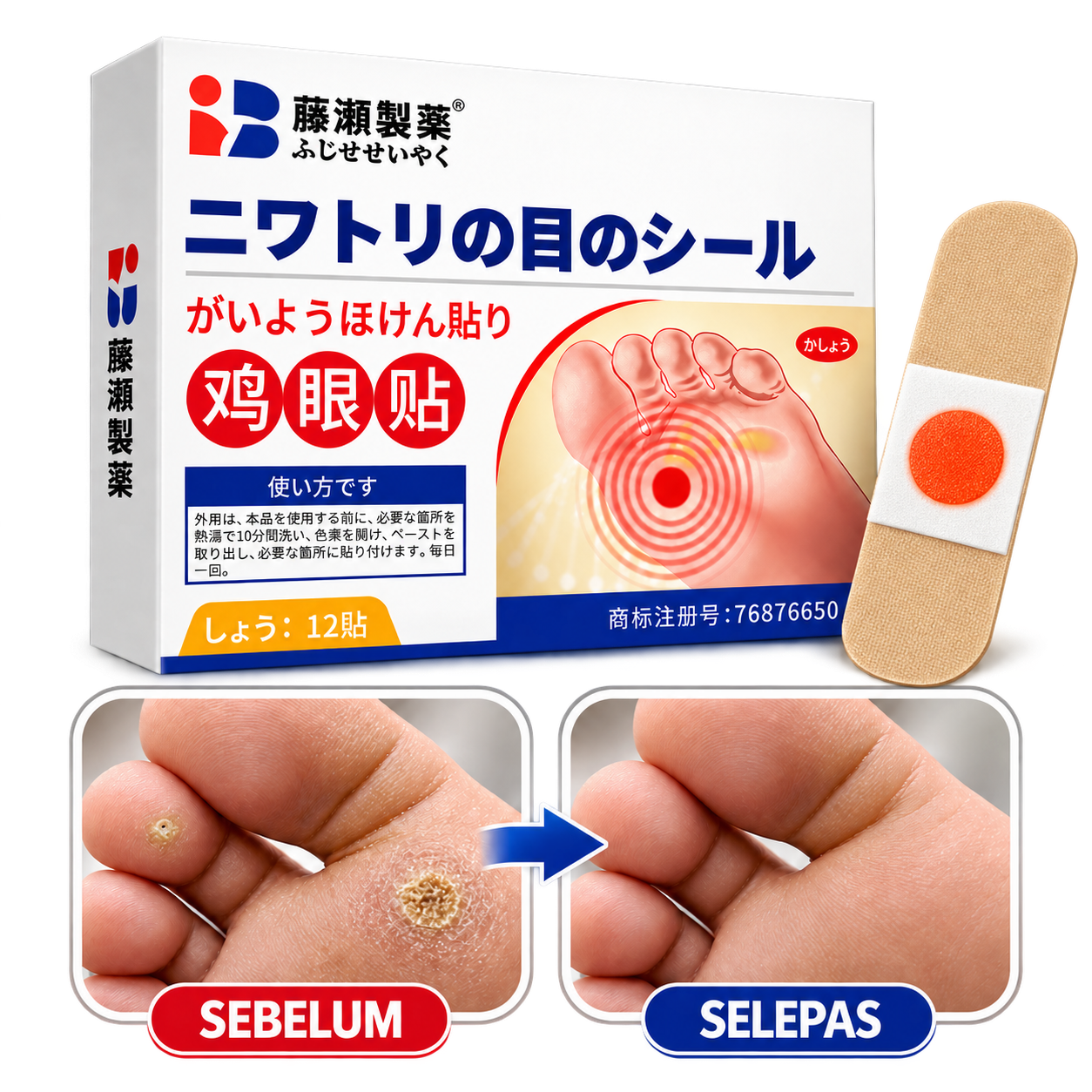 Plaster Ketuat